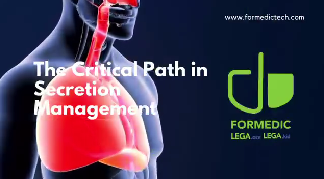 The Critical Path in Secretion Management